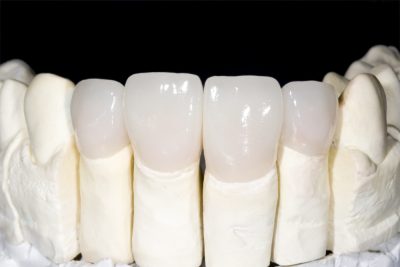 featured image for blog about the best dental service in Quezon city