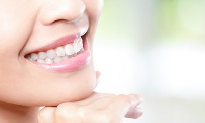 featured image for affordable dental clinic in Quezon City