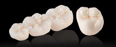 featured image for affordable dentist in QC