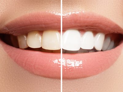 best cosmetic dentistry