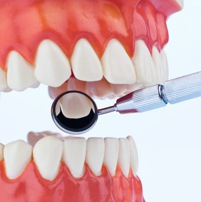 featured image for care for your teeth