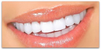 best teeth whitening