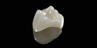 affordable porcelain crowns in Manila