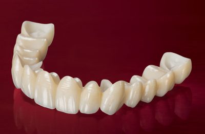 featured image for zirconia crowns in Manila