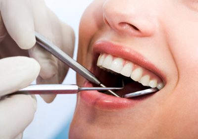 featured image for dental checkup