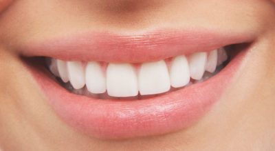 featured image for natural teeth whitening