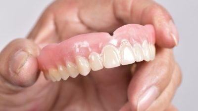 featured image for cost of false teeth in the Philippines