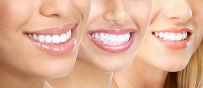 featured image for best cosmetic dentist in the philippines