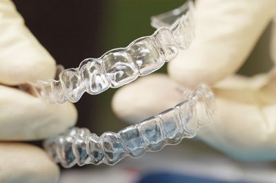 featured image for Price of Teeth Retainers in the Philippines