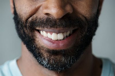 featured image for How to safely whiten teeth