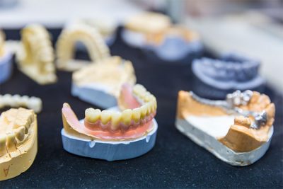 featured image for cost of dentures in Manila