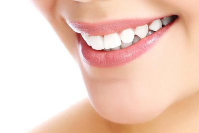 featured image for Are dental veneers worth it